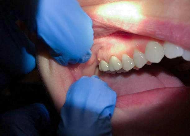 Best Same-Day Emergency Dental Services in Rochelle, GA